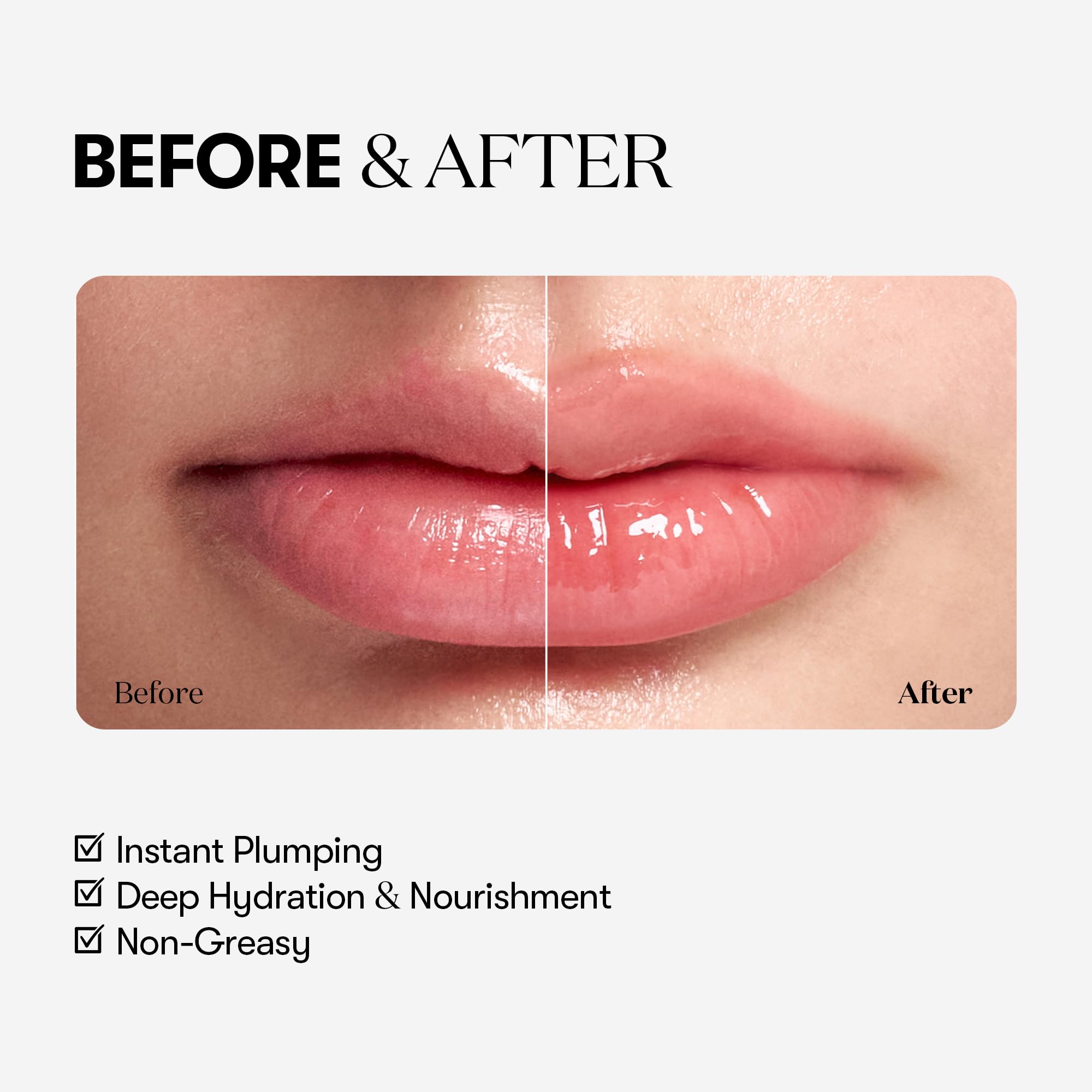 VT Reedle Shot Lip Plumper BEGINNER